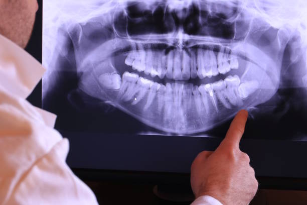 Best Broken Tooth Emergency  in Worthington Hills, KY